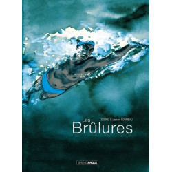 Les Brûlures - histoire...
