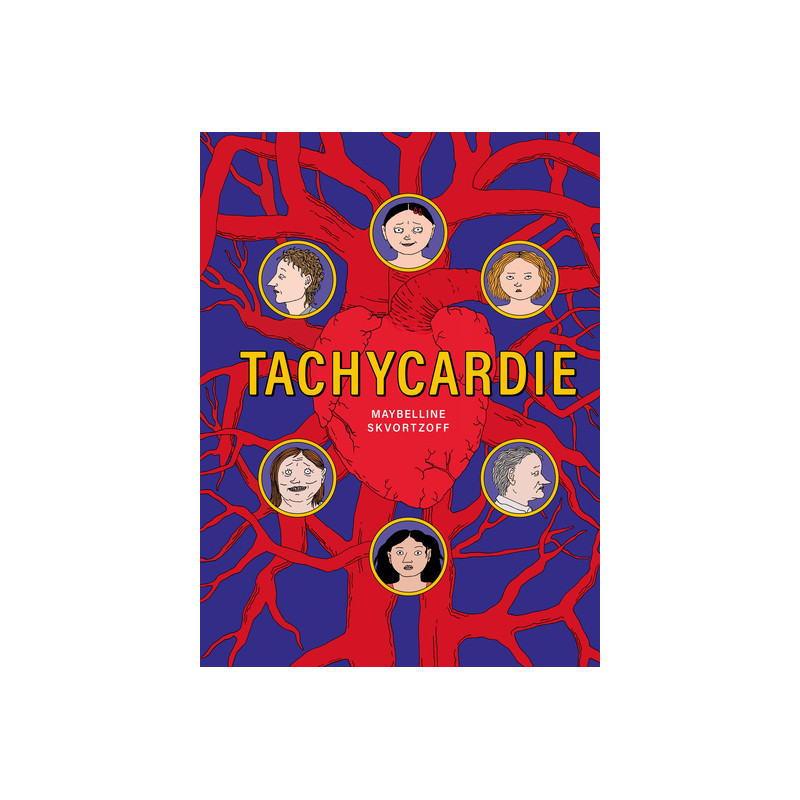 Tachycardie