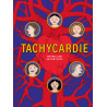 Tachycardie